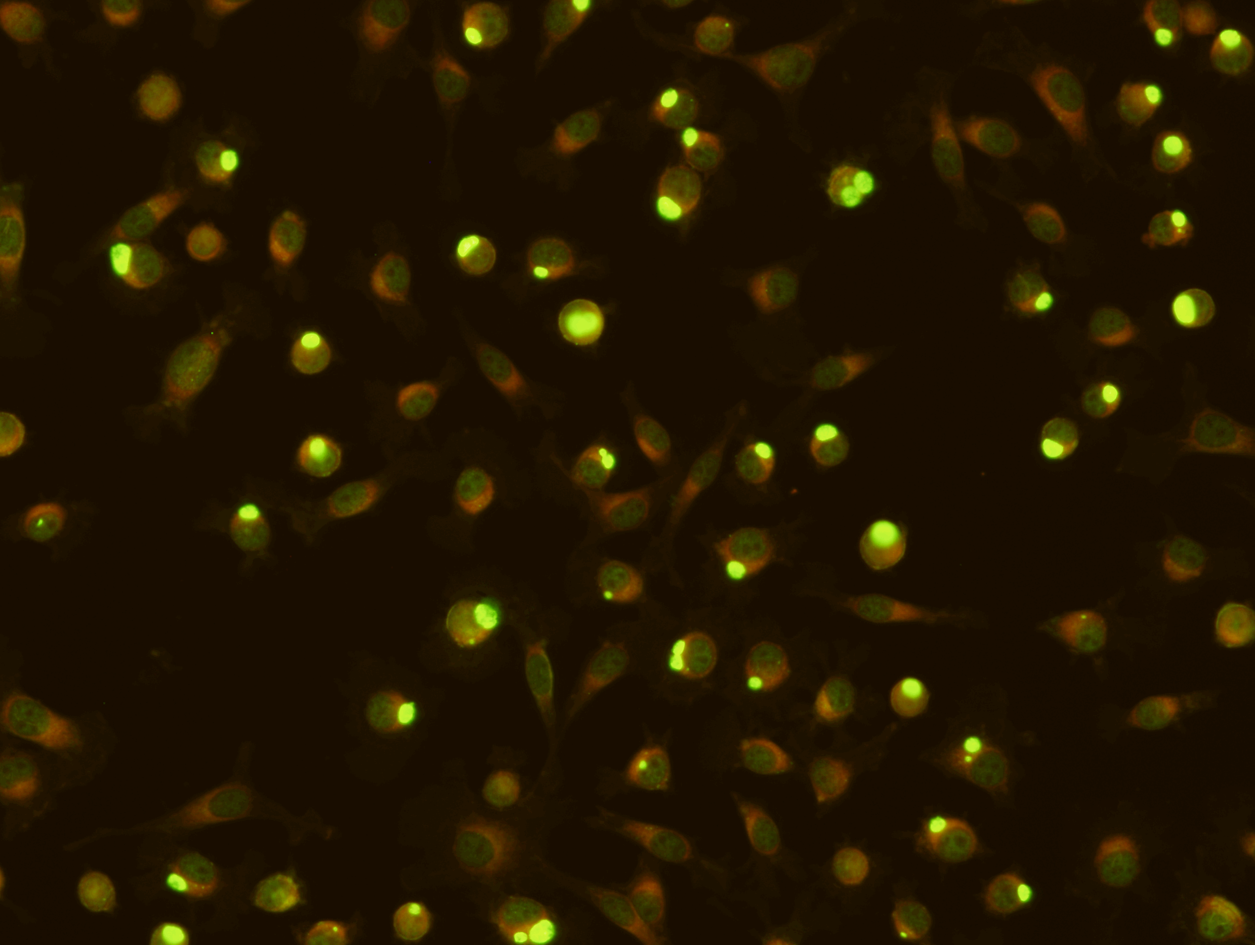  Chlamydia trachomatis IgG Test Kit  Chlamydia trachomatis IgM Test Kit (Export Only)  Intended for the qualitative and semi-quantitative detection of antibodies to chlamydiae in human serum or plasma. Detection of chlamydial antibodies in humans can