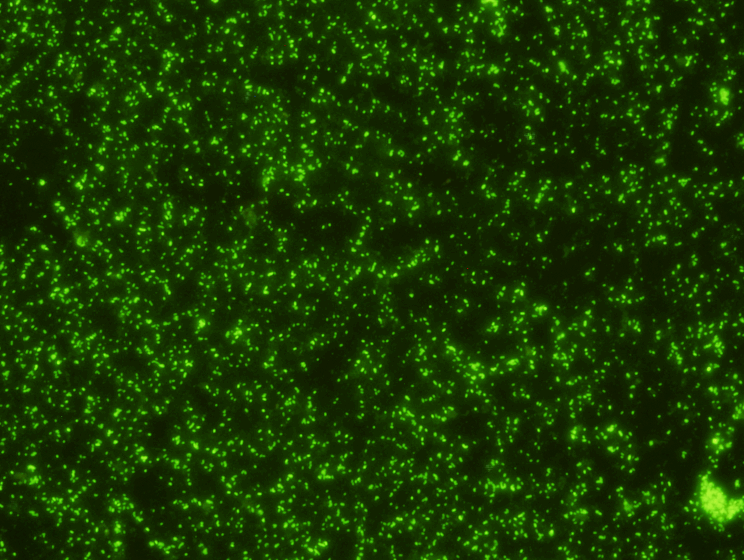  Coxiella burnetii (Q fever) IFA Slide  Intended for the serologic detection of anti- bodies to Coxiella burnetii. &nbsp;Each well contains fixed Phase I and Phase II. &nbsp;Virulent isolates are of the phase I type, while serial passage in eggs or t