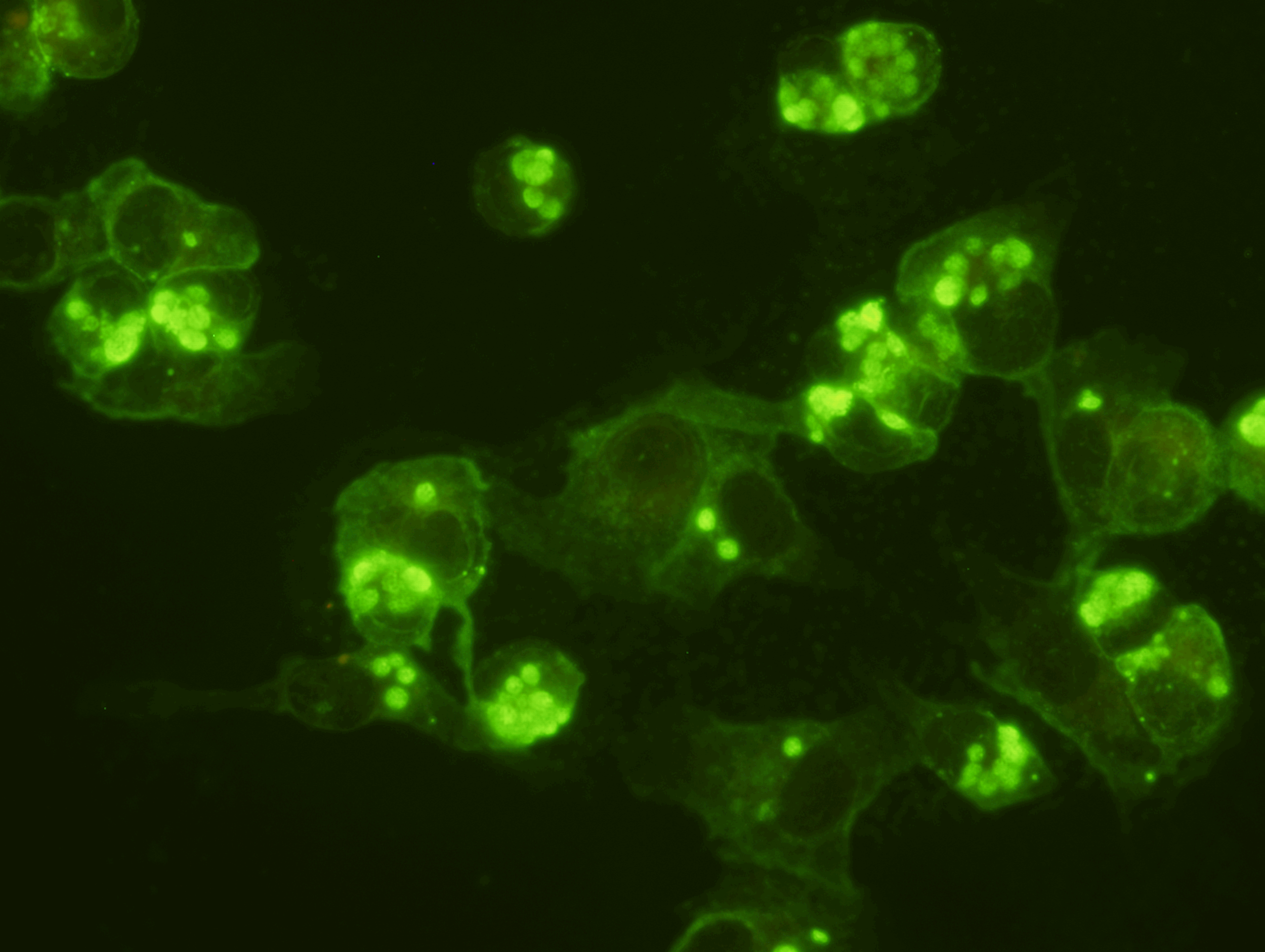  Ehrlichia chaffeensis IFA Slide  Intended for the serologic detection of antibodies to Ehrlichia chaffeensis, the causative agent of human monocytic ehrlichiosis (HME), in human serum. &nbsp;The human granulocytic ehrlichiosis (HGE) agent has recent