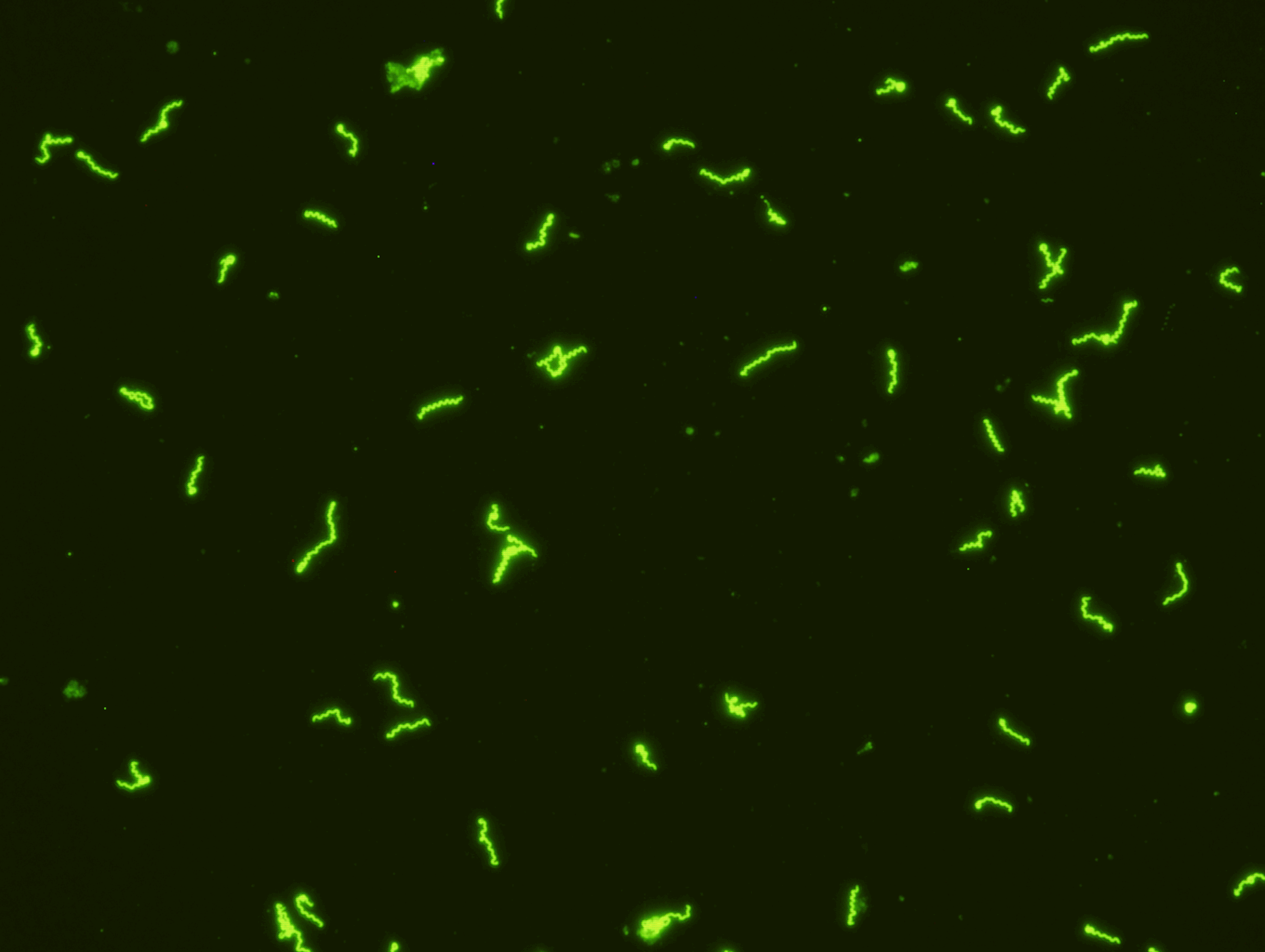   Fluorescent Treponemal antibody-absorption Test Kit ( Export Only)  Quantitative Immunofluorescence assay intended as a confirmatory procedure only in conjunction with a positive STS screening result for the diagnosis of syphilis. The FTA-ABS test 