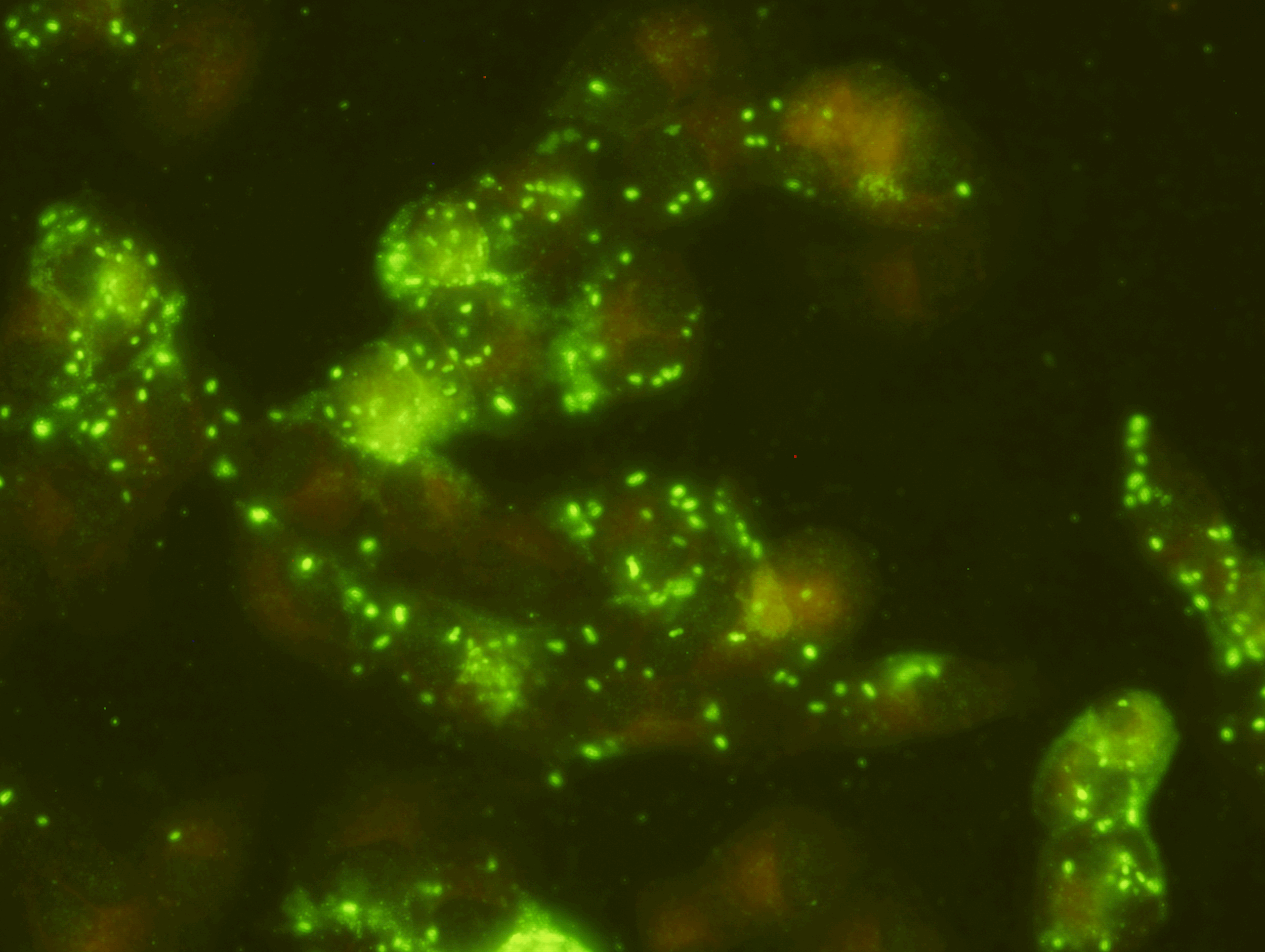   Rickettsia conorii IFA Slide   Indirect Fluorescence Assay for Rickettsia conorii IgG Antibody is intended for the qualitative and semi-quantitative detection of IgG antibody to R. conorii in human serum or plasma. This test can be used as an aid i