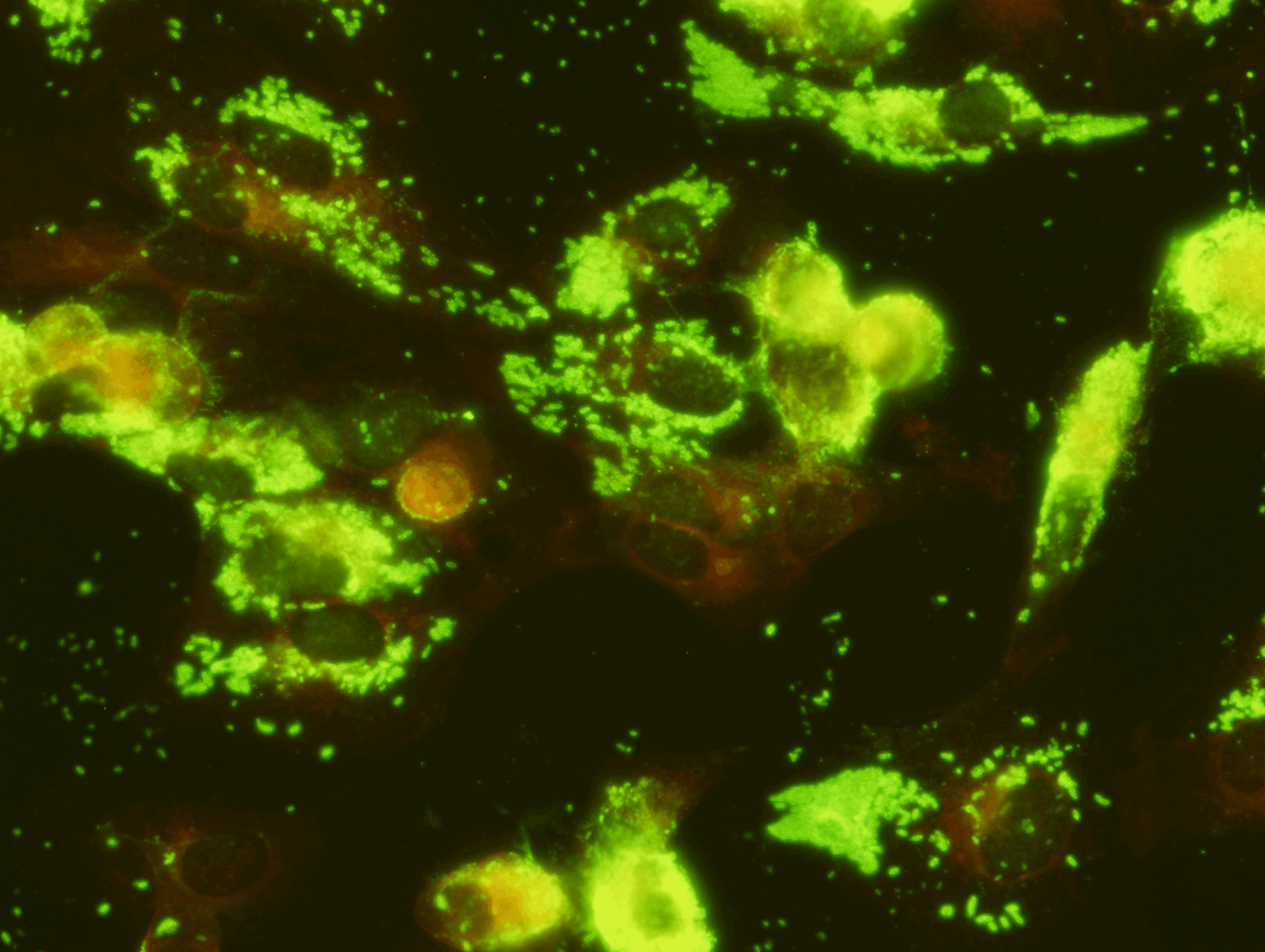   Rickettsia typhi IFA Slide   Indirect Fluorescence Assay for Rickettsia typhi IgG Antibody is intended for the qualitative and semi-quantitative detection of IgG antibody to R. typhi in human serum or plasma. This test can be used as an aid in the 