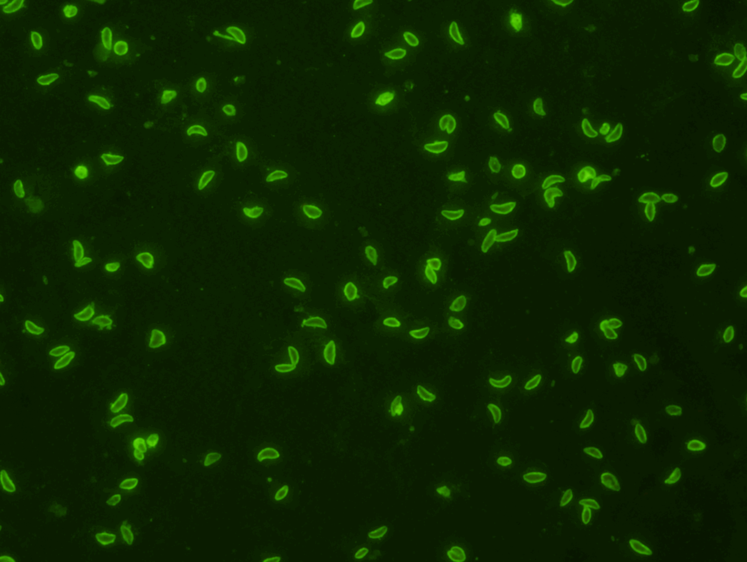   Toxoplasma gondii IgG 120 Test Kit   (Export Only)  Indirect Fluorescence Assay for Toxoplasma gondii IgG Antibody is intended for the qualitative and semi- quantitative detection of IgG antibody to T. gondii in human serum or plasma.&nbsp; This te