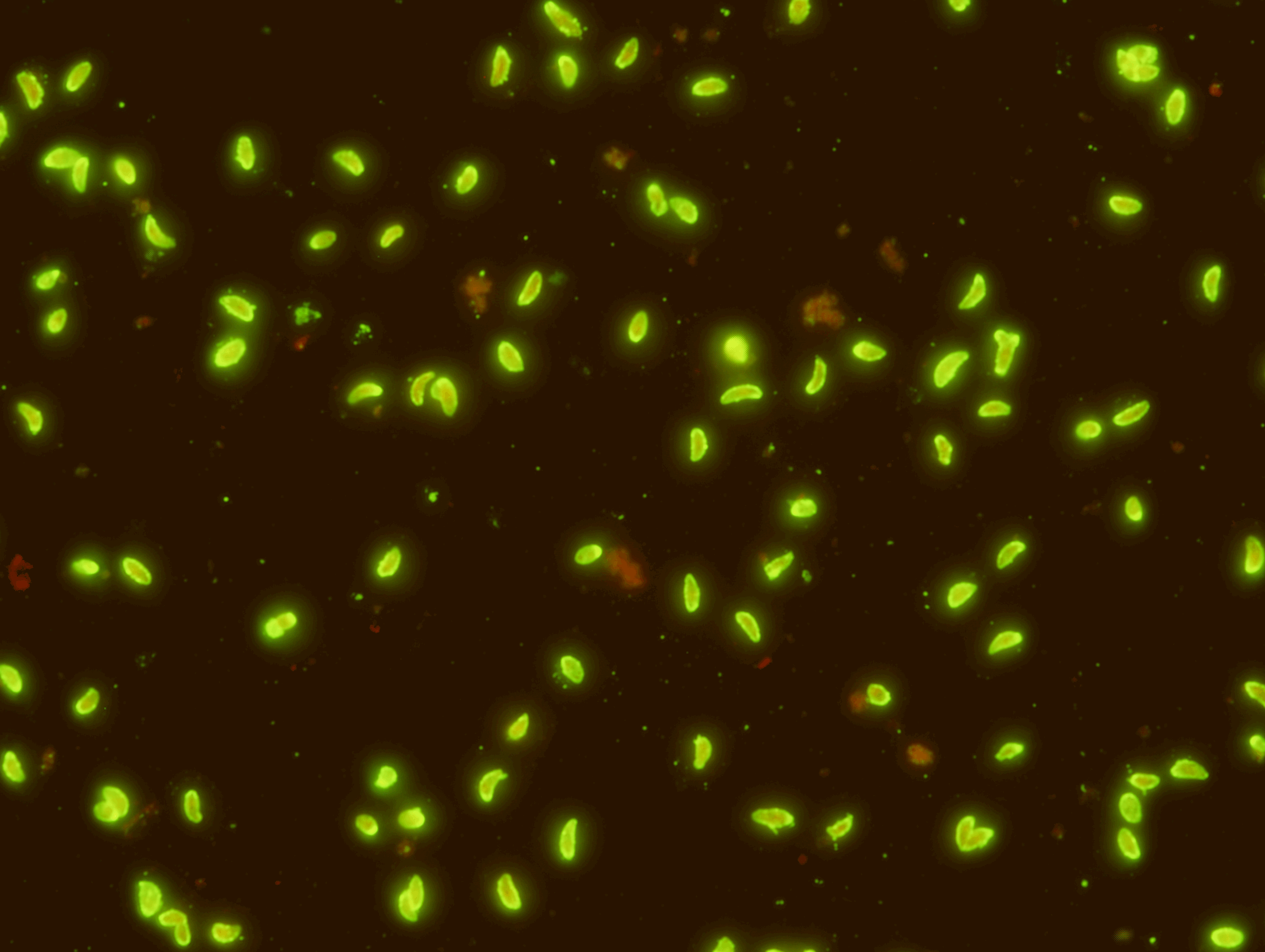   Toxoplasma gondii IgM Test Kit     ( Export Only)  Indirect Fluorescence Assay for Toxoplasma gondii IgM Antibody is intended for the qualitative and semi-quantitative detection of IgM antibody to T. gondii in human serum or plasma. This test can b
