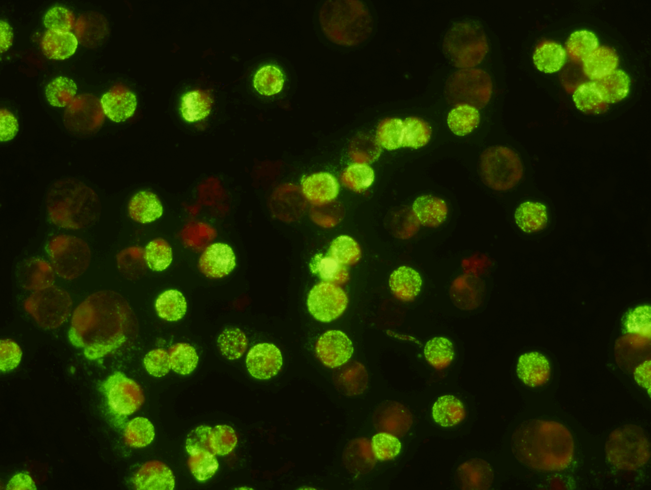  Epstein Barr Virus Nuclear Antigen ACIF Test Kit   ( Export Only)  Anti-complement immunofluorescence (ACIF) method for the qualitative and quantitative detection of antibodies to the nuclear antigen of Epstein-Barr virus in human serum or plasma. 
