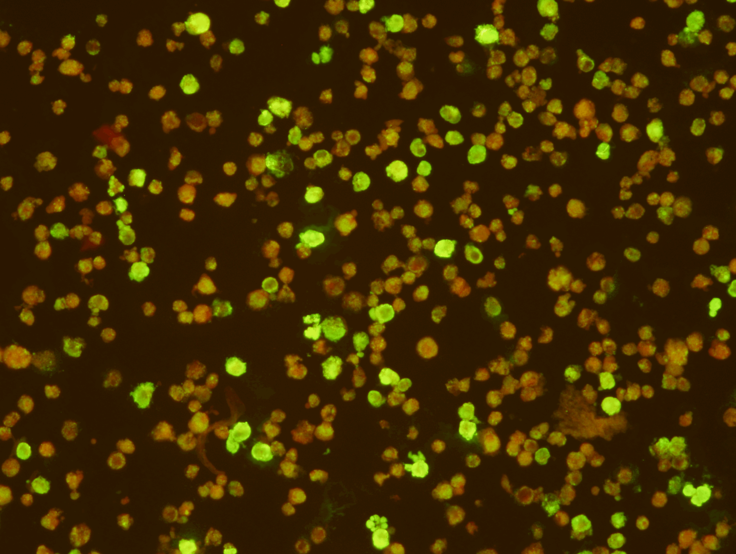   Epstein Barr Virus Early Antigen Test Kit   (Export Only)  Intended for the qualitative and semi-quantitative detection of IgG antibody to the early antigen complex of the Epstein-Barr virus in human serum. The EBV-EA IFA Test Kit should be used in