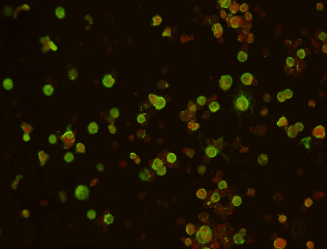   Human Herpesvirus 6 IgG Test Kit (Export Only)  Intended for the qualitative and semi-quantitative detection of IgG antibody to Human Herpesvirus 6 in human serum or plasma. This test can be used as an aid in the diagnosis of primary infection or r