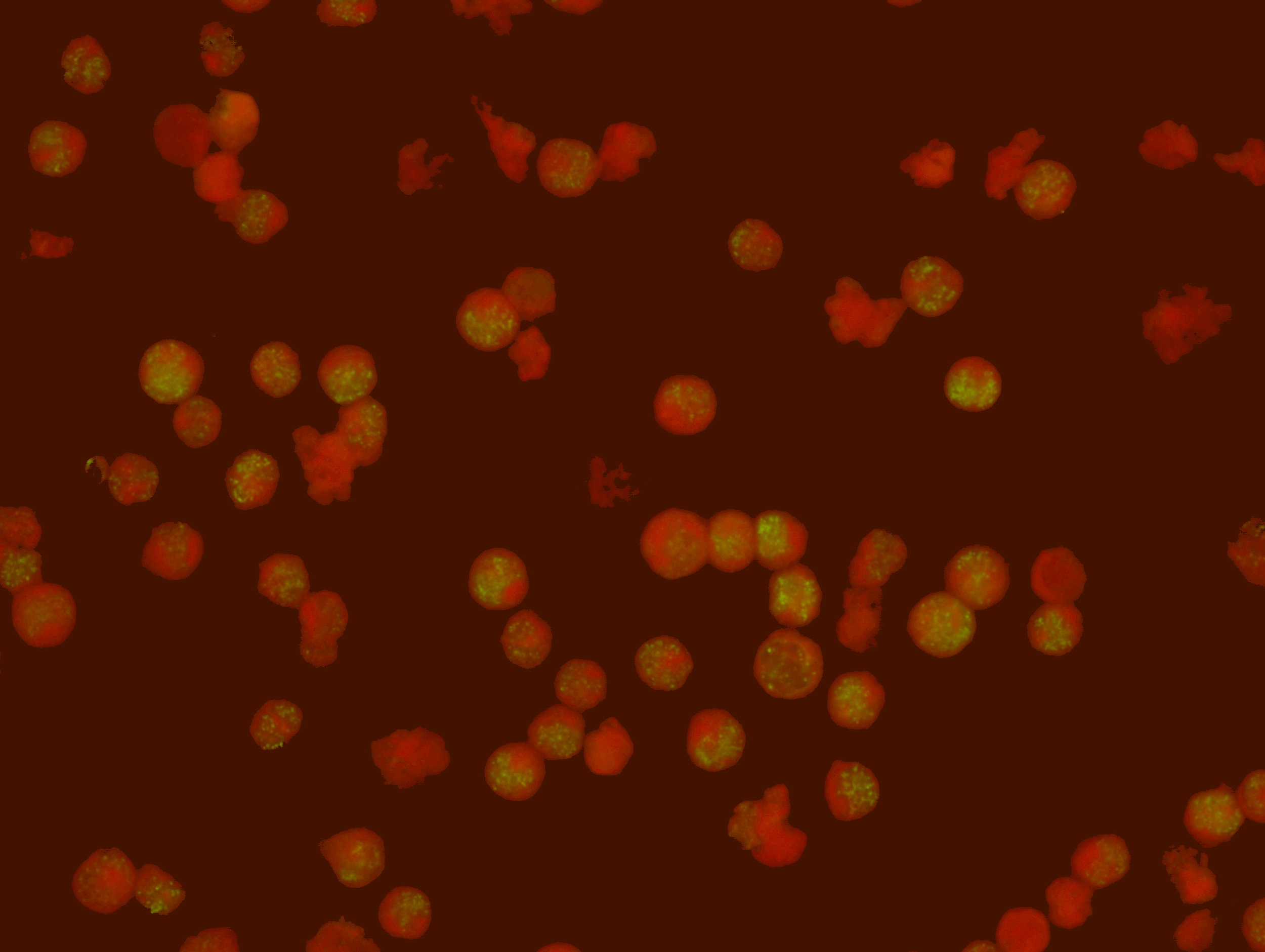   Human Herpesvirus 8 IgG (Latent) Test Kit (Export Only)  Intended for the qualitative and semi-quantitative detection of IgG antibody to Human Herpesvirus 8 latent antigens in human serum or plasma. This test can be used as an aid in the diagnosis 