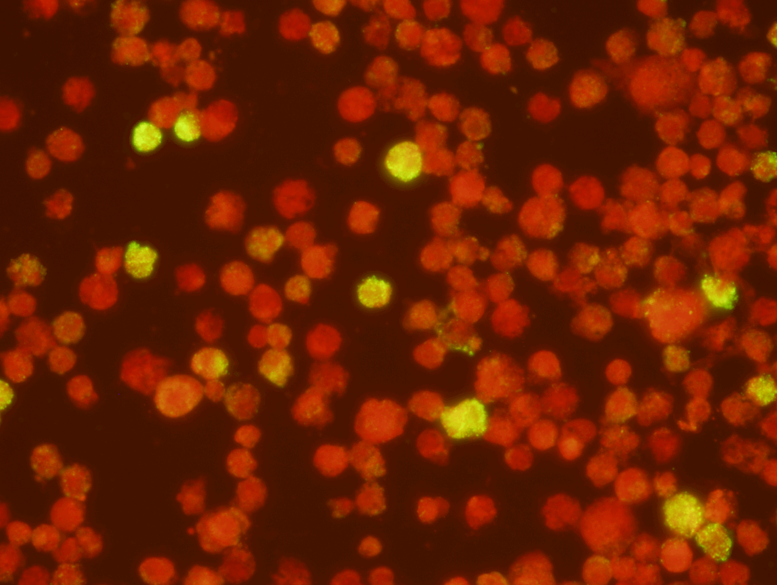   Epstein-Barr Virus (VCA) IgM Test Kit ( Export Only)  Intended for the qualitative and semi-quantitative detection of IgM antibody to Epstein-Barr Virus-Viral Capsid Antigen (EBV-VCA in human serum or plasma. This test can be used as an aid in the 