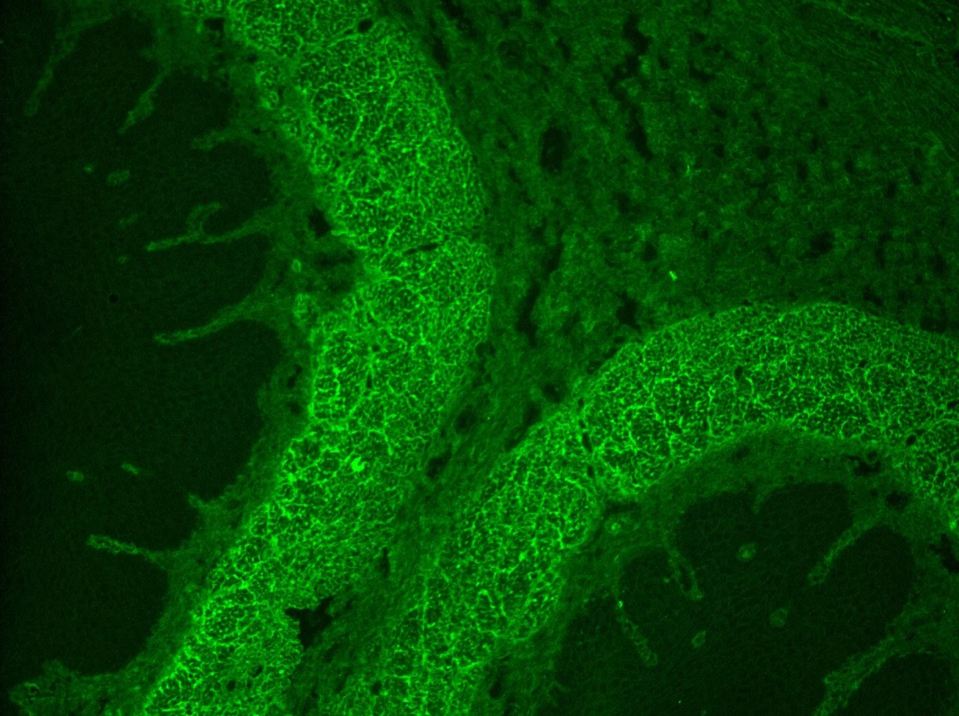 MeDiCa IIF Anti-Endomysial Antibody (AEmA) Test Kit