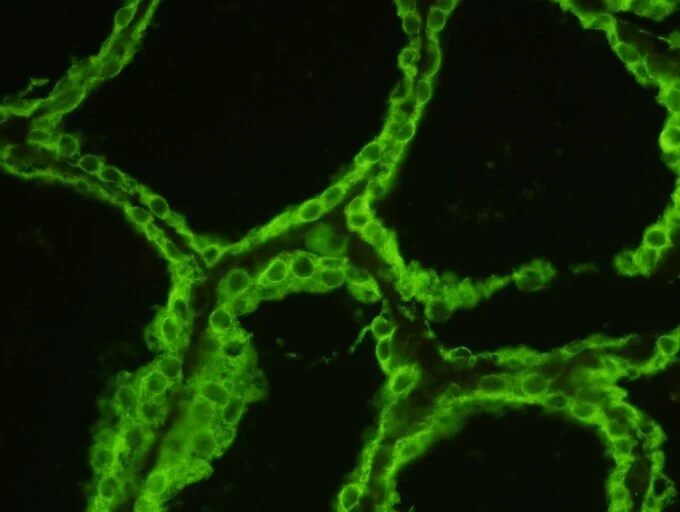 MeDiCa IIF Anti-Thyroid Antibody (Microsomal) Test Kit