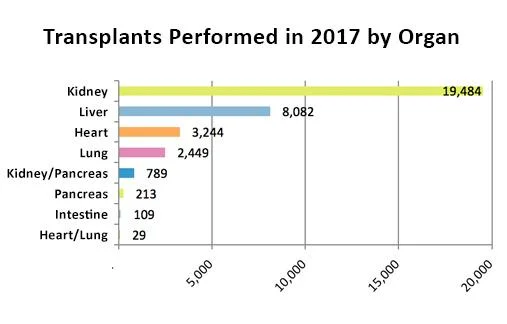 Intestine transplant is the least common single-organ transplant. Graphic from https://www.organdonor.gov/statistics-stories/statistics.html.