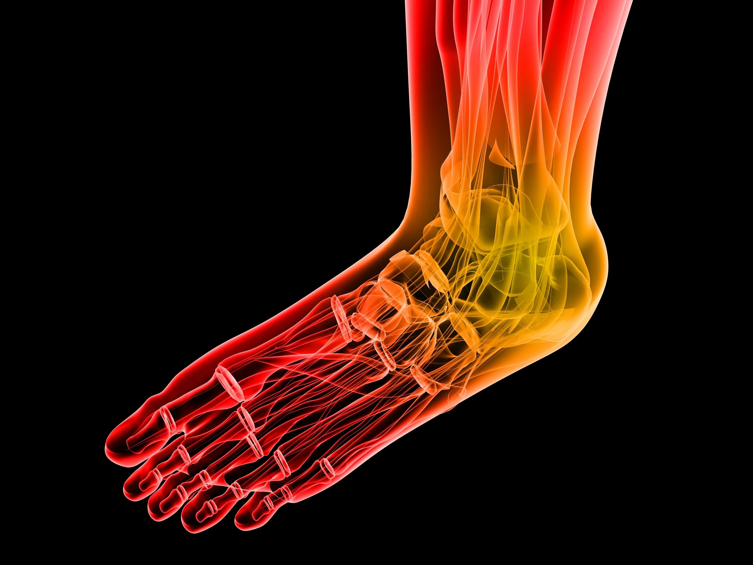 Nerve Disorders Neuroma, Neuropathy Fairfax VA Podiatrist — CENTER