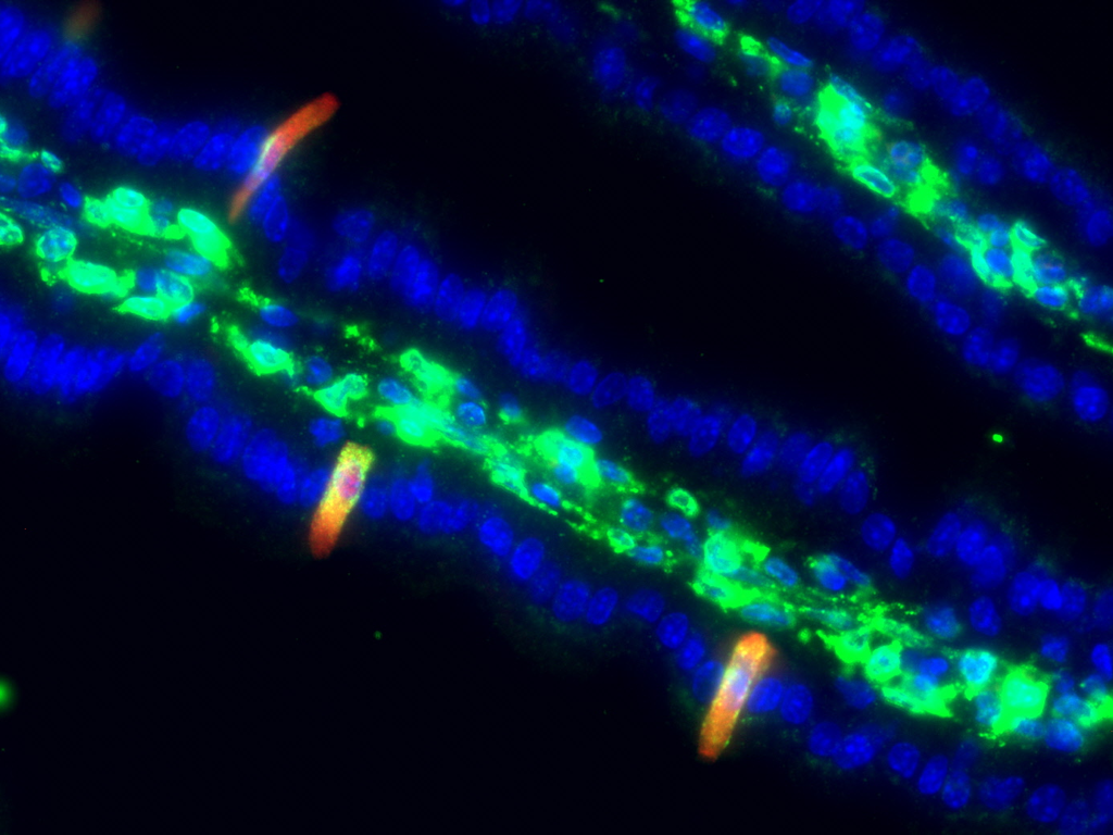 PTGS1 (green) and IL-25 (red) co-staining of tuft cells in the small intestine. Nuclei in blue. 