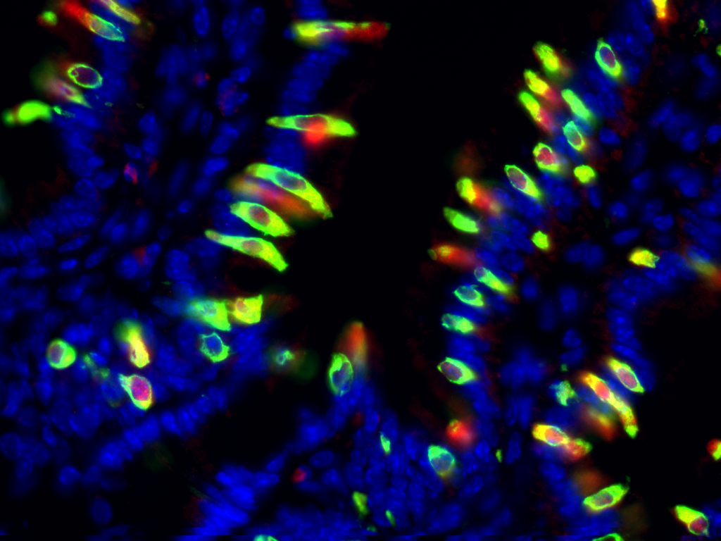 IL-25 (red) and DCLK1 (green) co-staining of tuft cells in the small intestine during helminth infection. Nuclei in blue. 