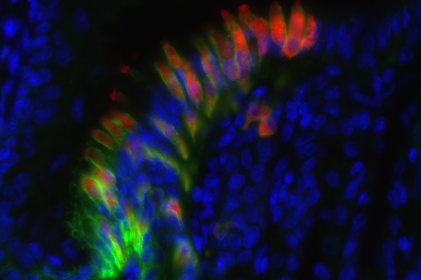 IL-25+ tuft cells (red) and EPCAM+ (green) epithelium at the limiting ridge of the mouse stomach. Nuclei in blue. 