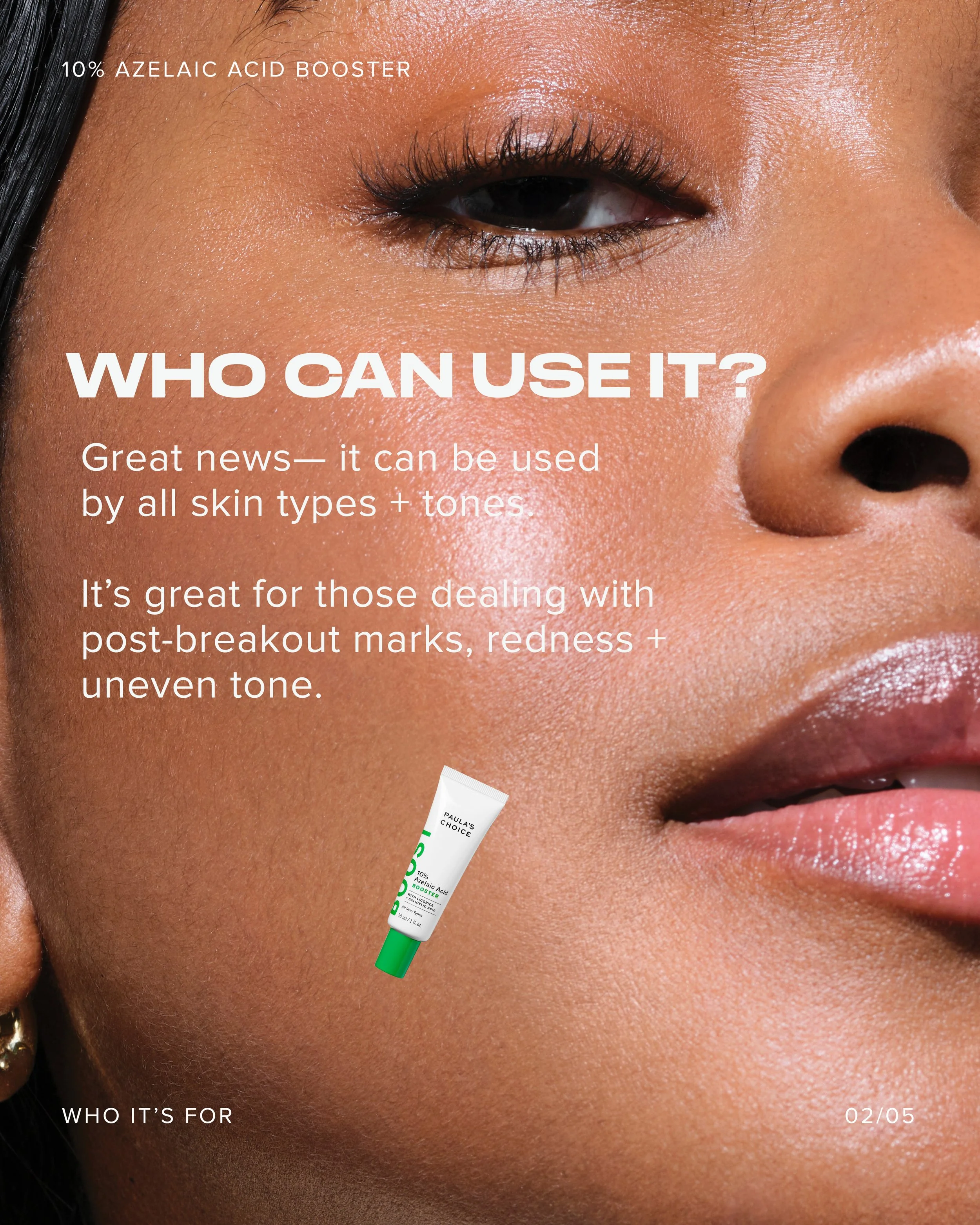 Azelaic Acid Booster Guidance Carousel 2025_Slide 3.jpg
