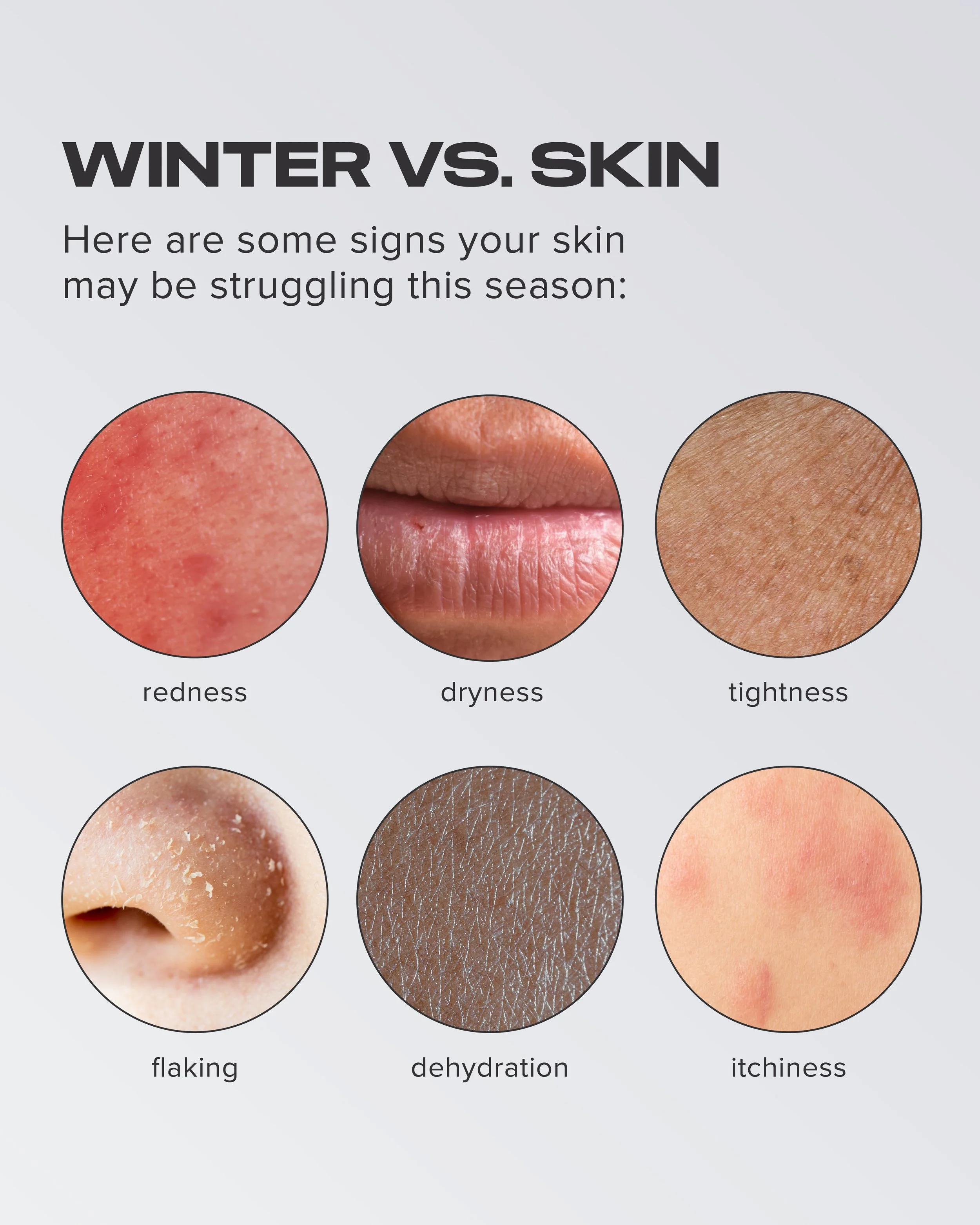 FINAL_Winter Skin Carousel 2025_Signs_Slide 3.jpg