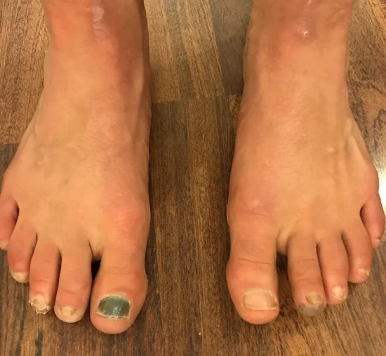 The feet...