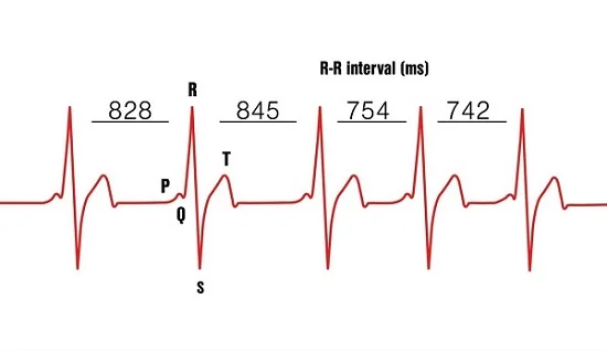 Heart Rate Variability