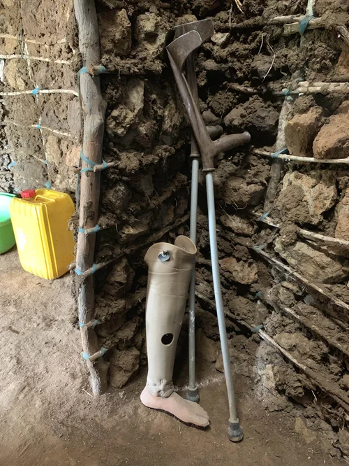 The old prosthesis and crutches Arnold used for the last ten years