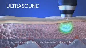 New GeneO+ Ultrasound feature