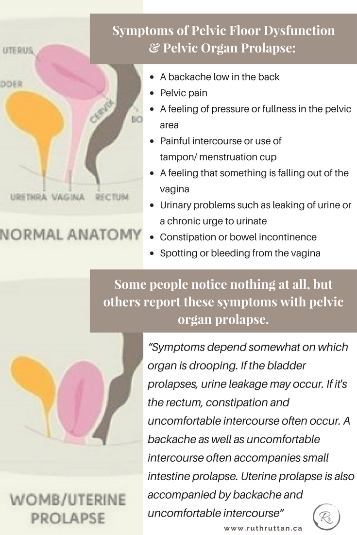 What Are The Symptoms Of Pelvic Floor Dysfunction | Viewfloor.co