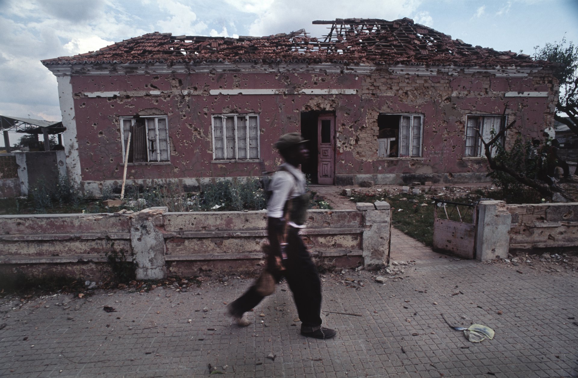  "War Acne"&nbsp;Angola's destructive civil war. Quito, Angola, 1993 