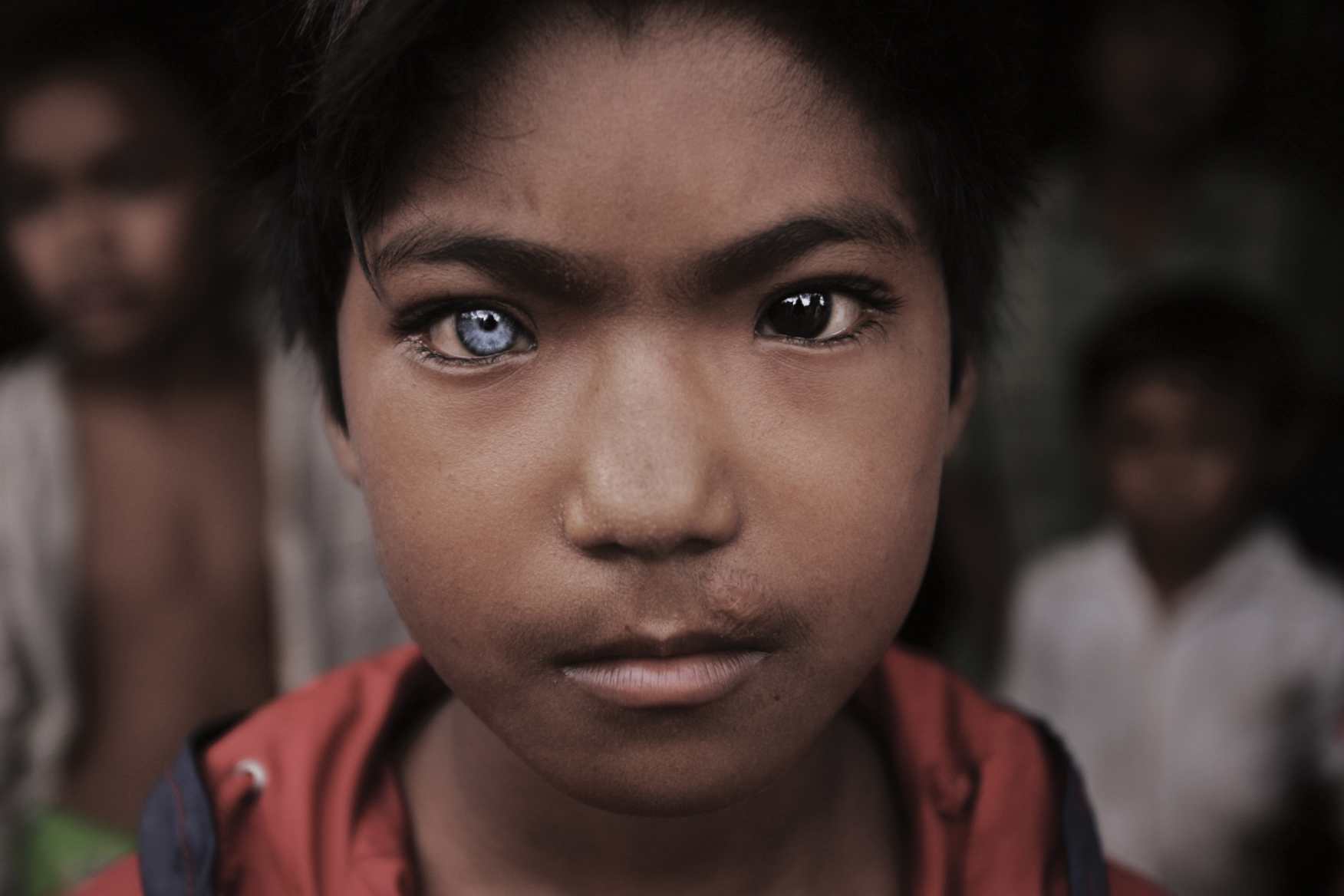  Blue Eyed, Brown Eyed Boy. Cambodia-Thai border. 2008 