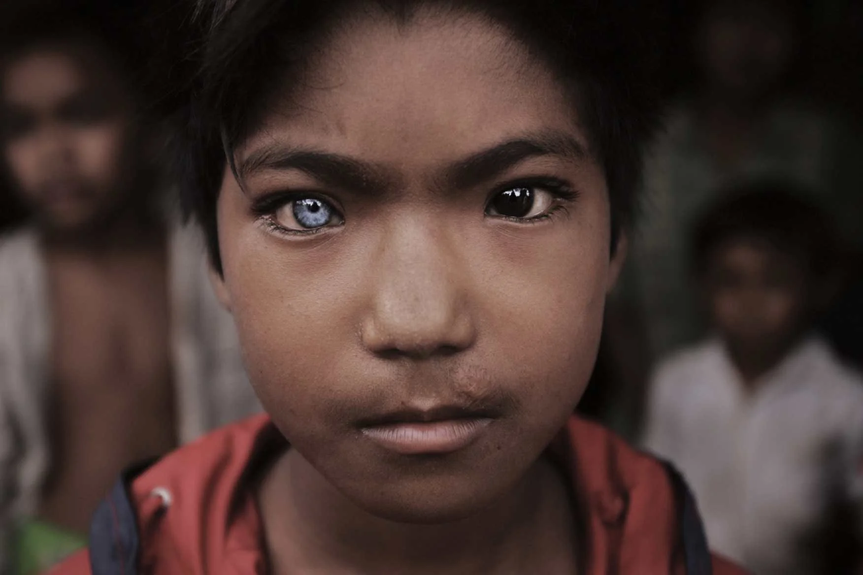 Blue Eyed, Brown Eyed Boy. Cambodia-Thai border. 2008