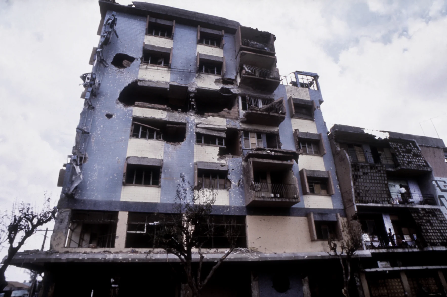 "War Acne" Angola's destructive civil war. Quito, Angola, 1993