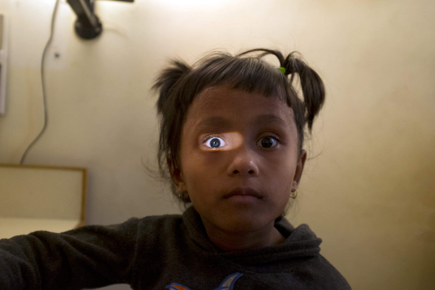  Eye treatment. Kathmandu, Nepal. 2013 