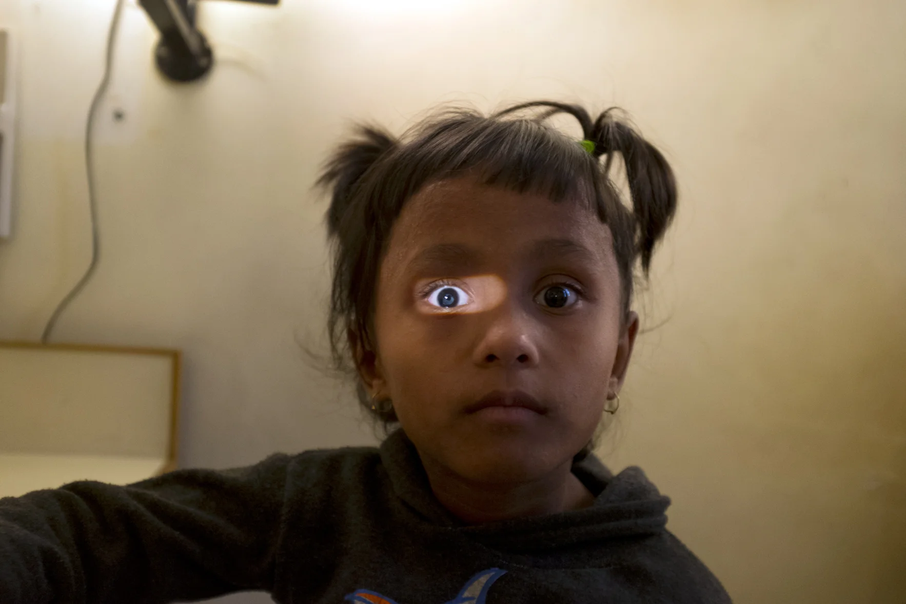 Eye treatment. Kathmandu, Nepal. 2013