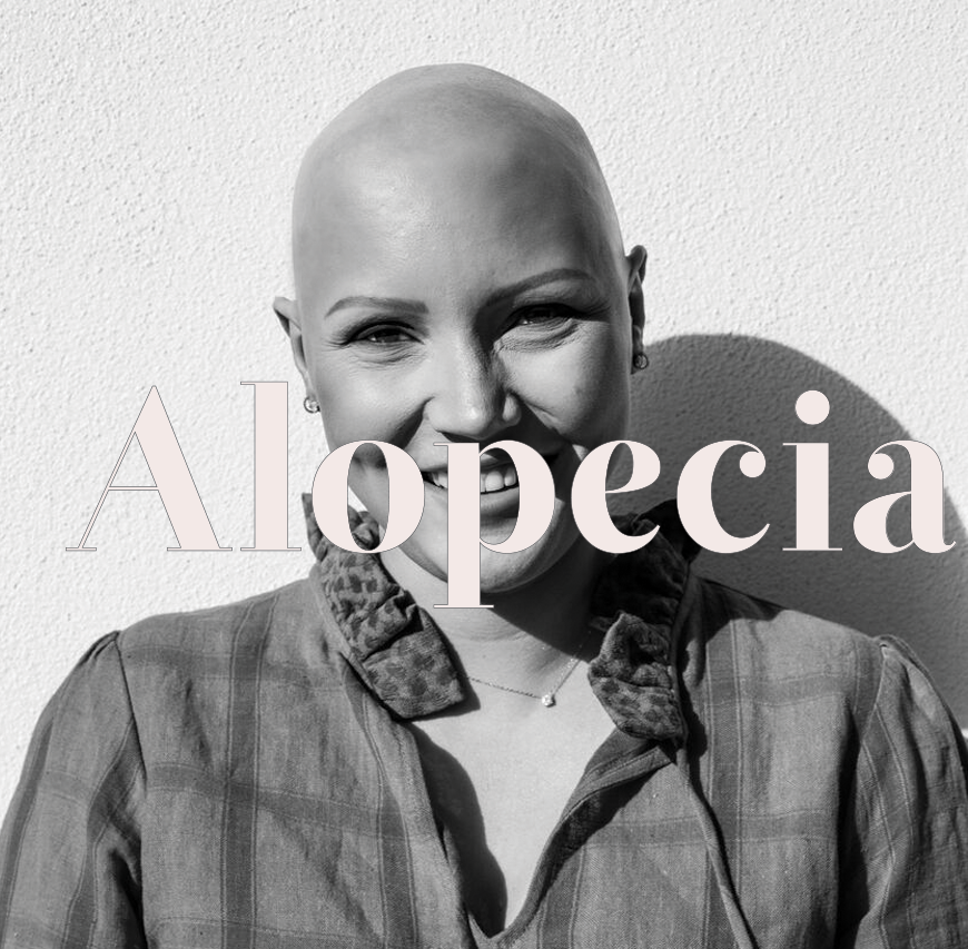 image-alopecia-01.png