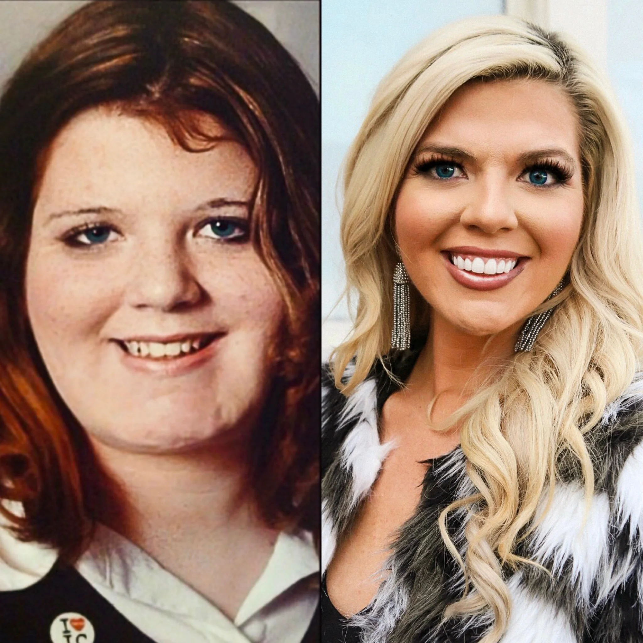 My Weight loss Story - The How