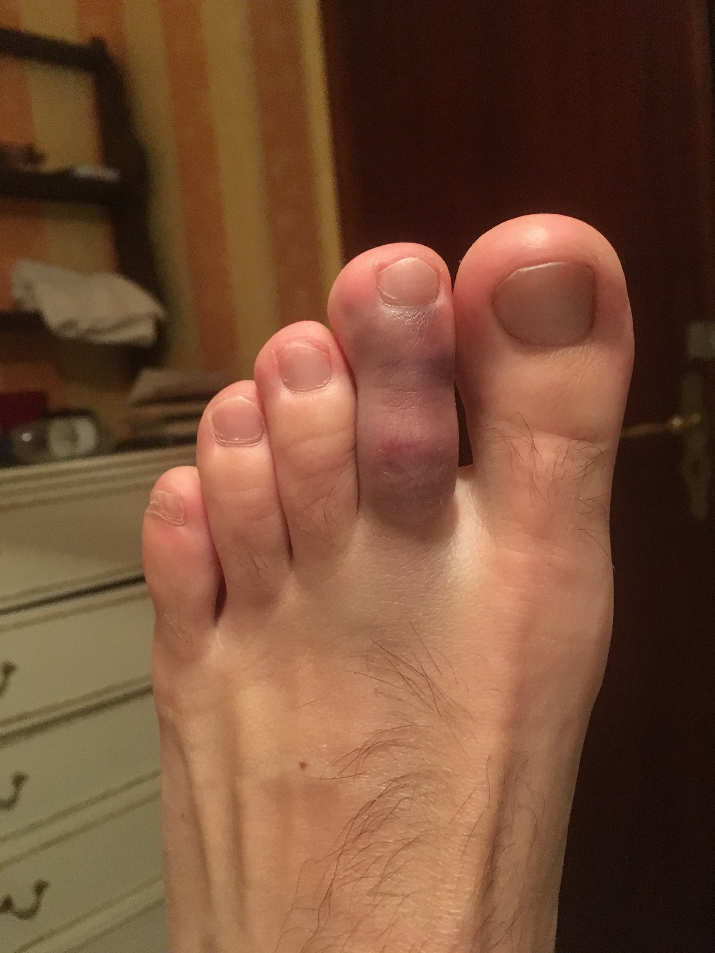 No running by the pool