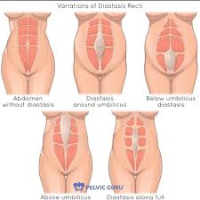 Permission to use image from Pelvic Guru LLC
