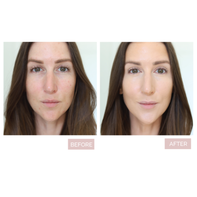 Before_After_Conceal_400x.png