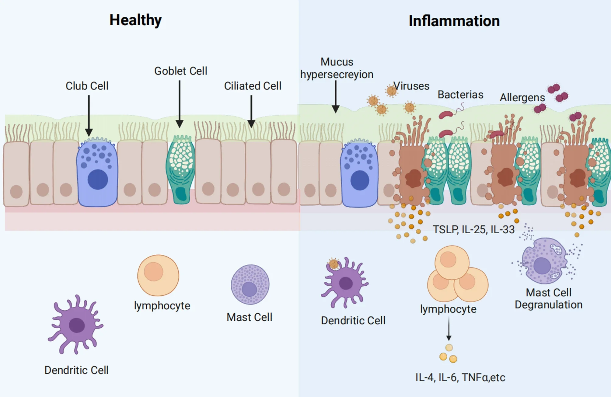 A diagram showing healthy vs inflamed sinuses to explain the cause of mcas