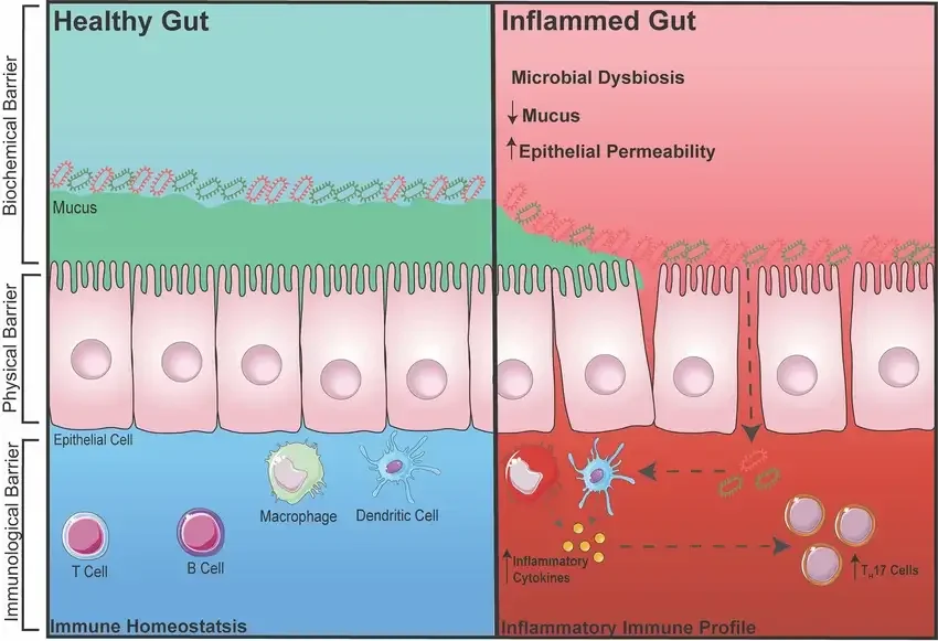 A diagram comparing a healthy gut to an inflammed gut and how that causes chronic disease.