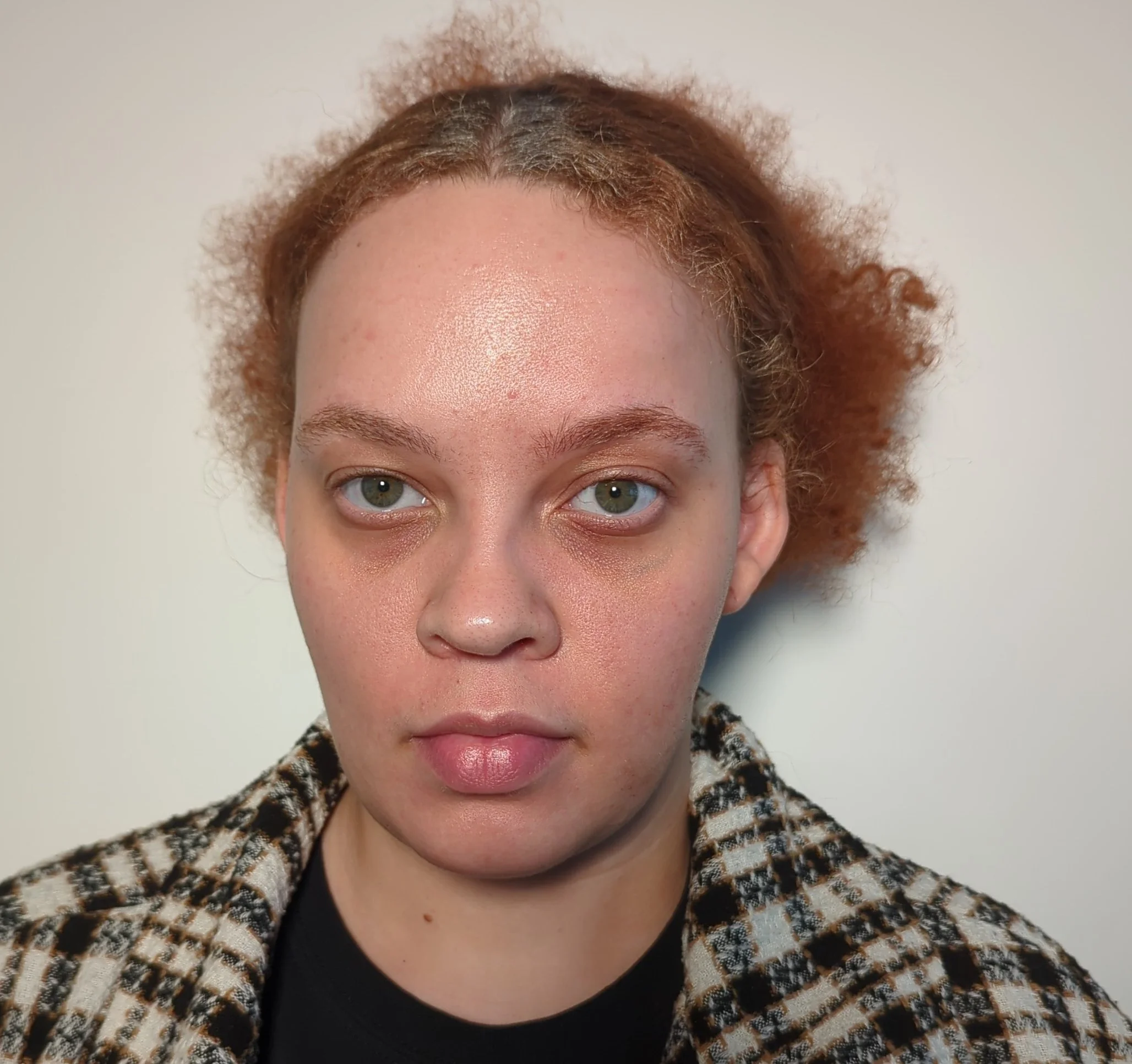 Basic FX Scar - Before
