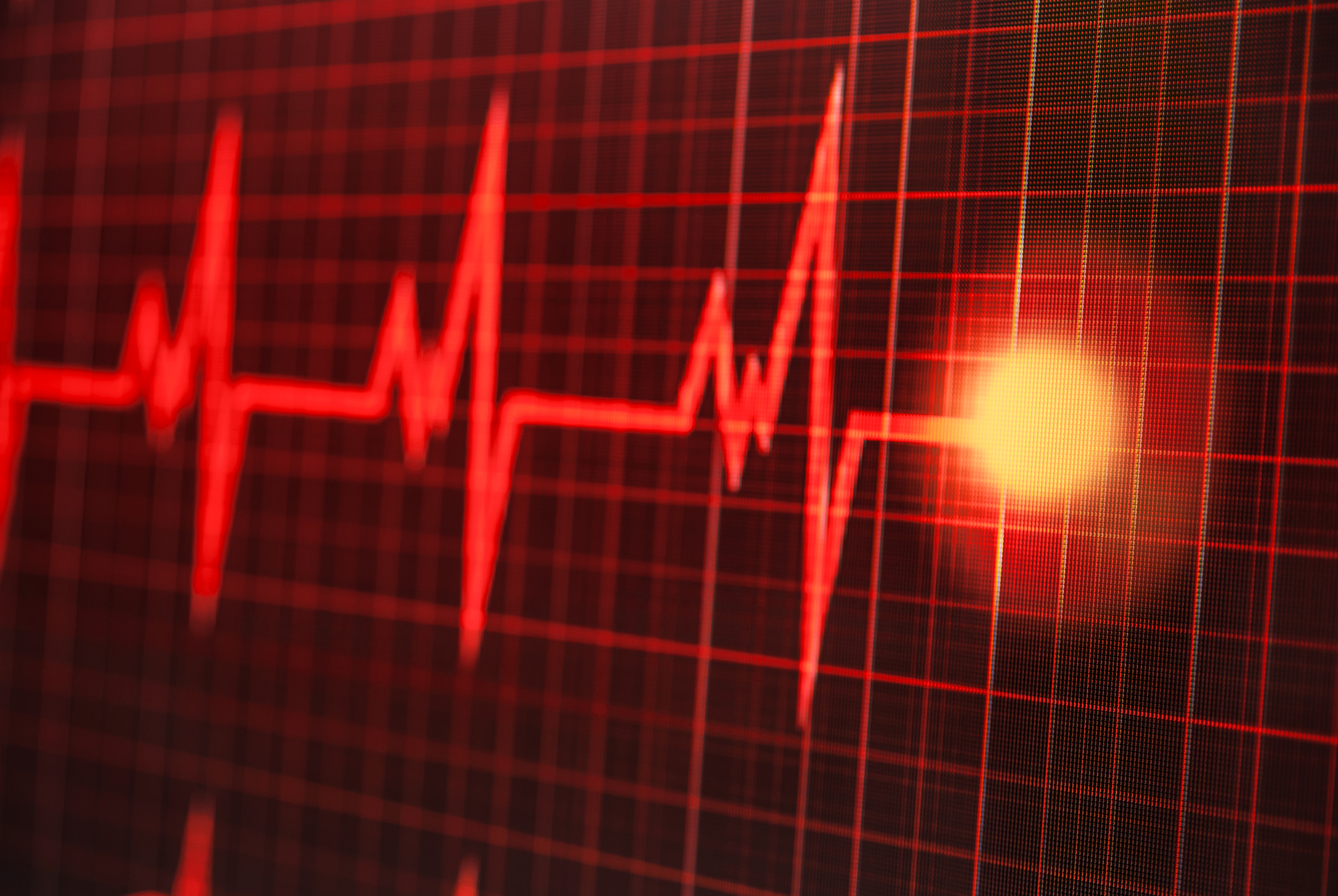 Align Management Rhythm