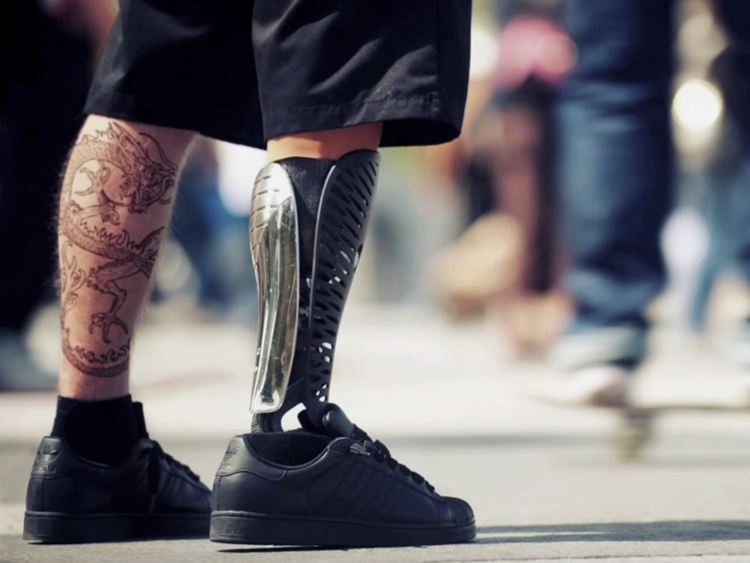 Reducing the Costs of Prosthetic Manufacturing