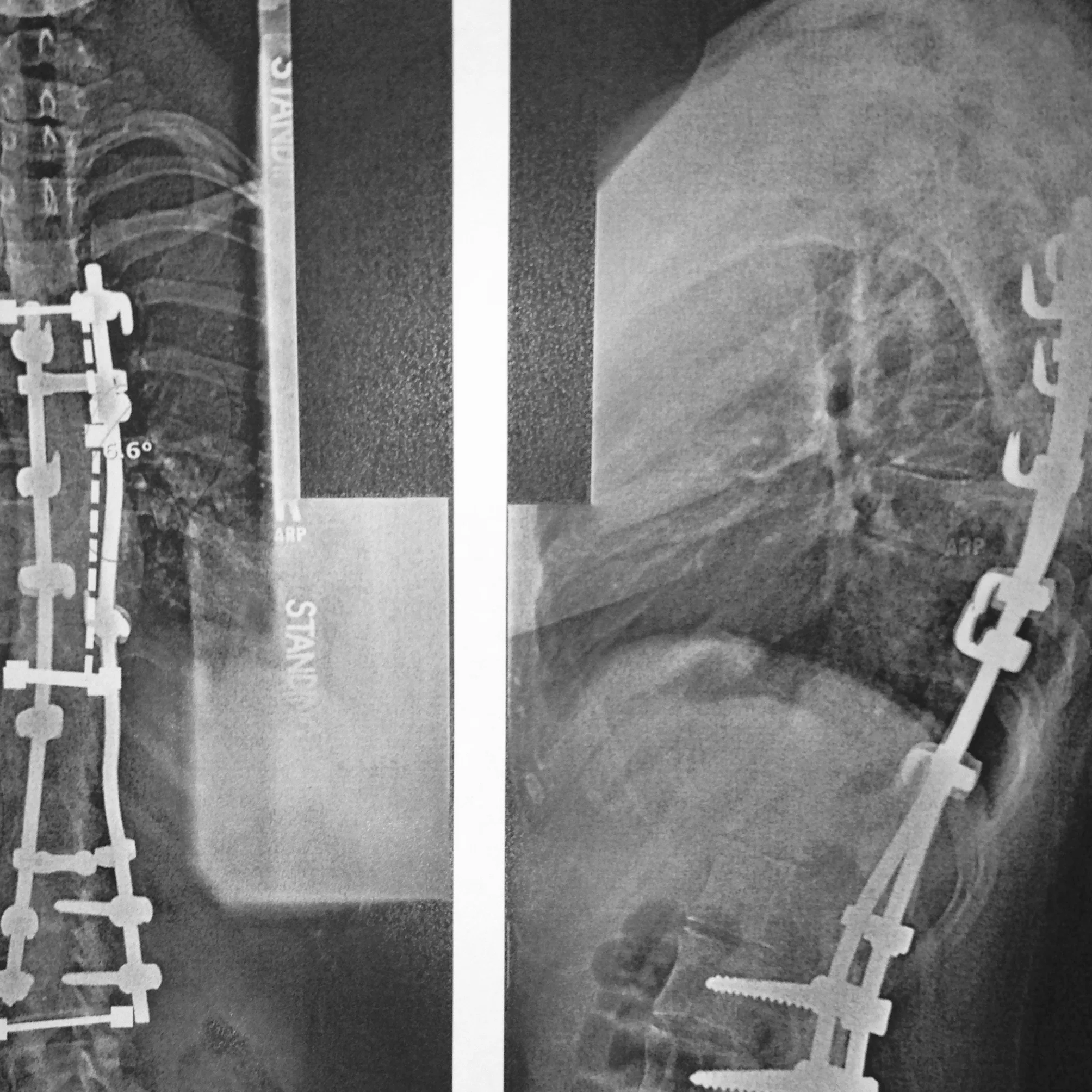 This is my last X-ray, from several years ago. How epic is that?