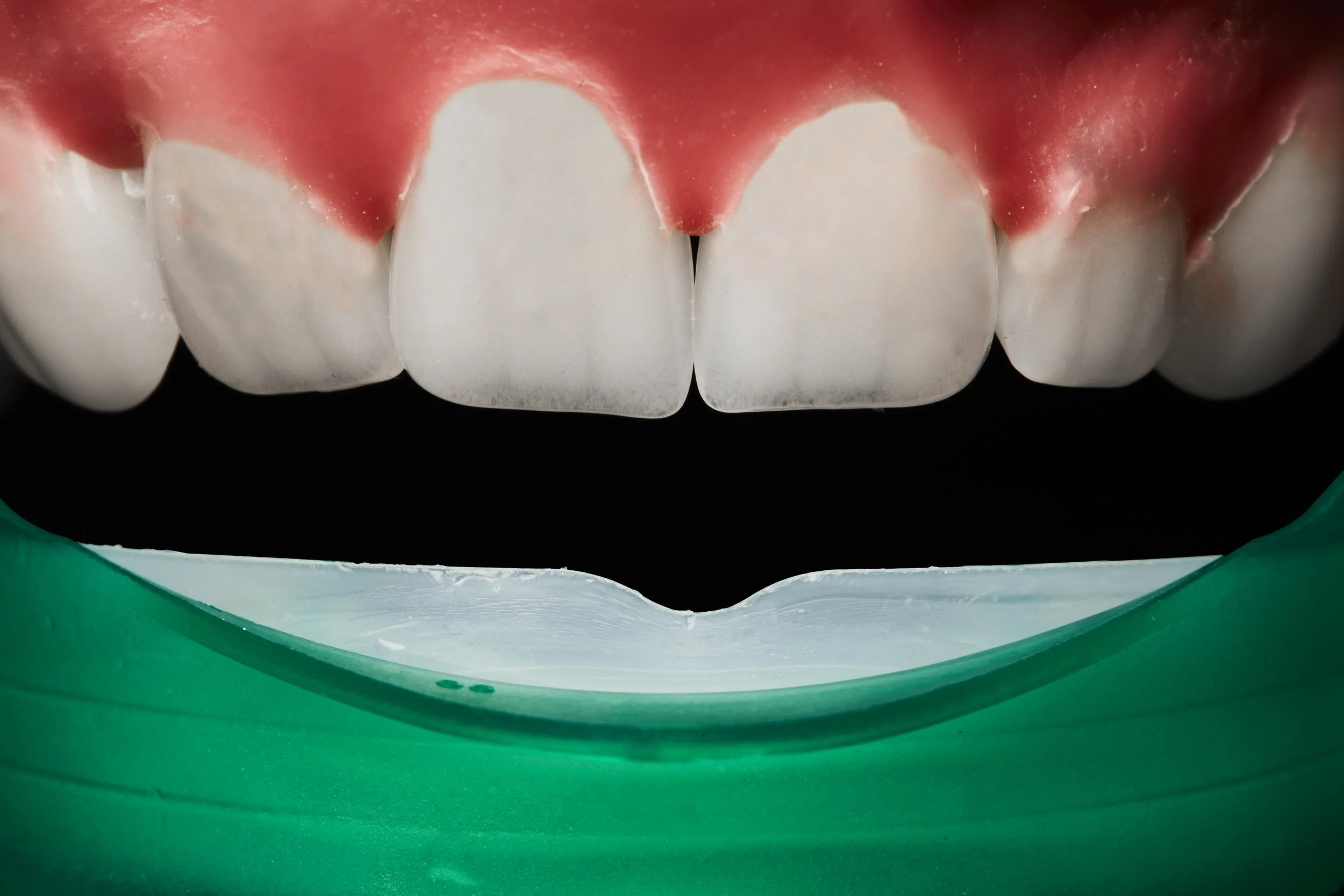 teeth whitener_006_comp draft.jpg
