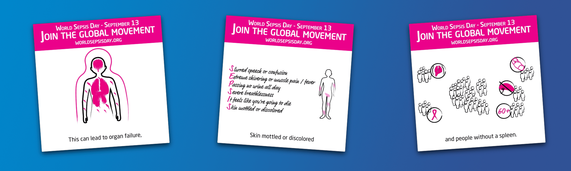 Sepsis Awareness Clips Banner.png