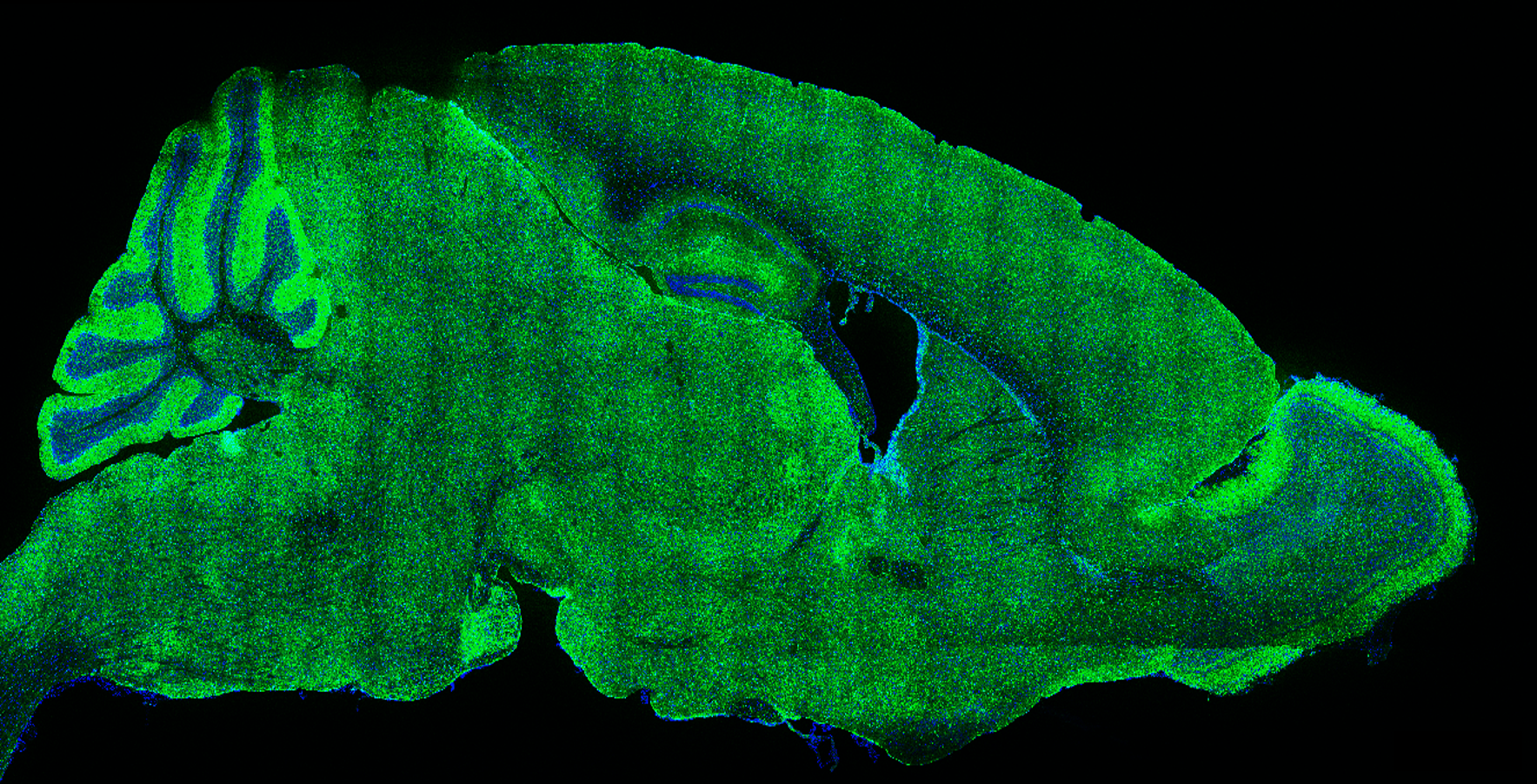 Astrocytes in the brain