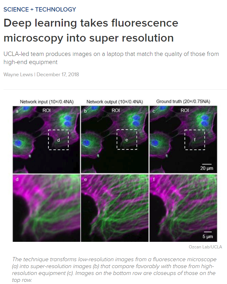 Deep learning takes fluorescence microscopy into super resolution