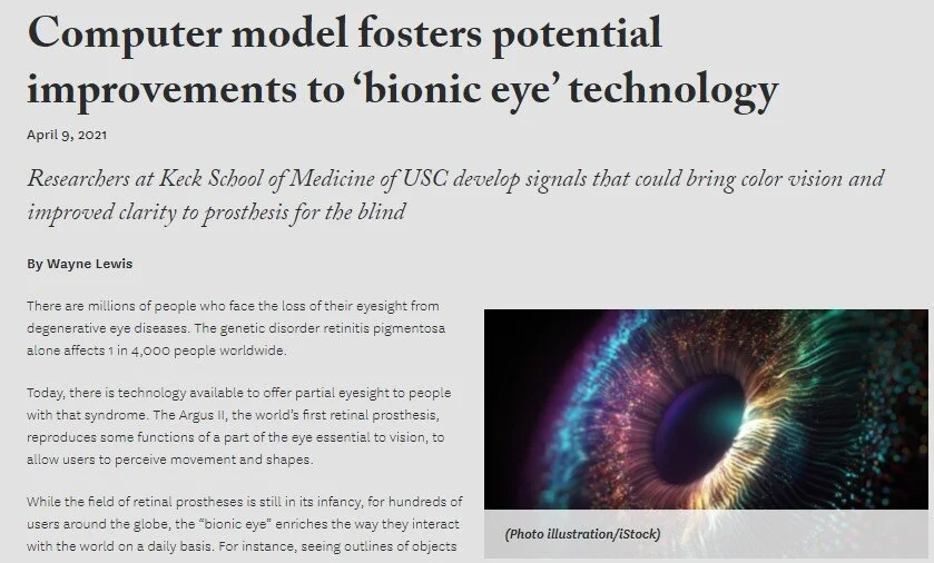 Computer model fosters potential improvements to ‘bionic eye’ technology