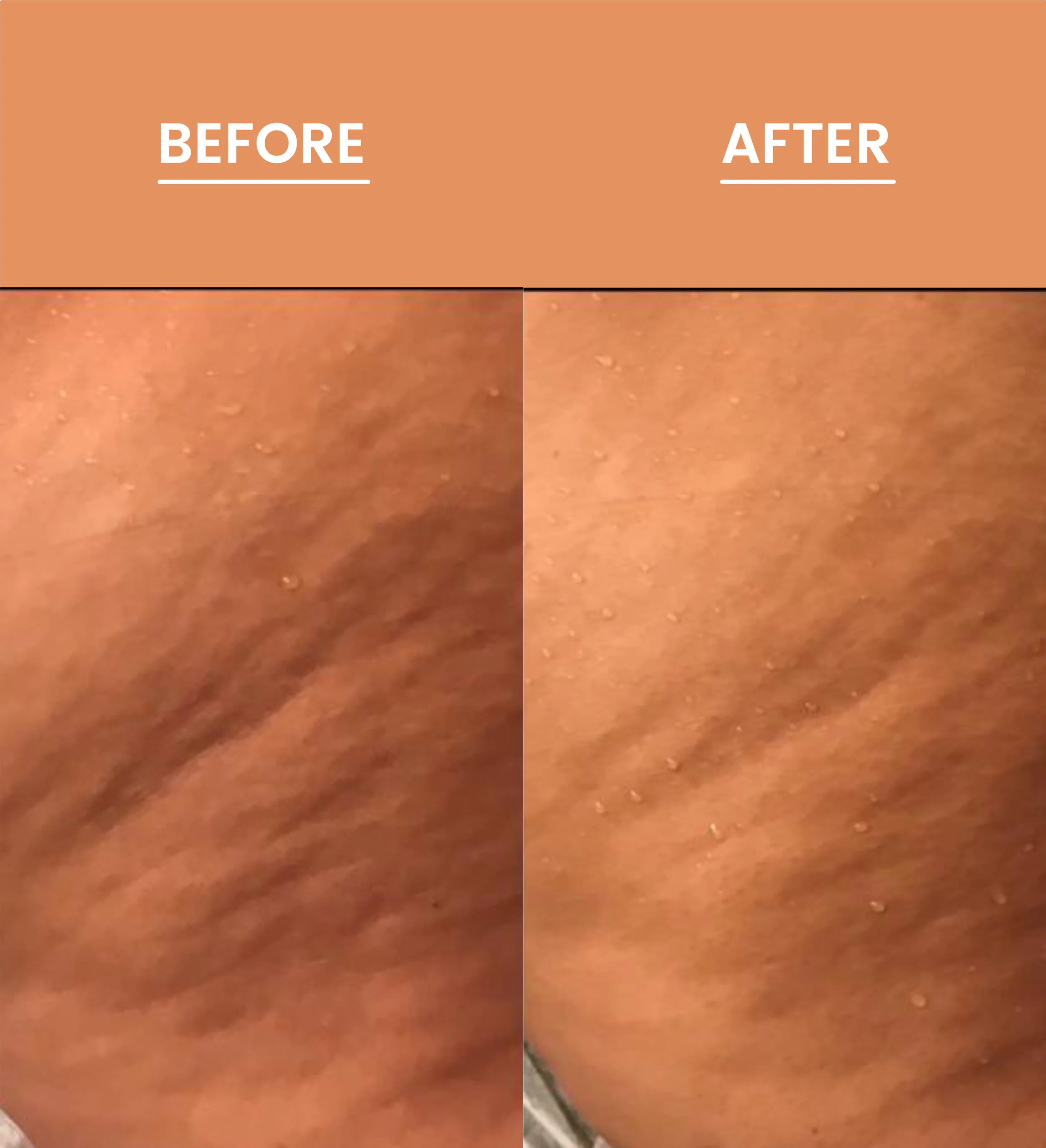 before_after_2.jpg